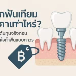 ฟื้นชีวิตใหม่ให้ฟันด้วยรากฟันเทียม ทางเลือกทันตกรรมที่มั่นคงและยั่งยืน